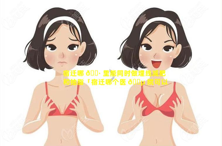 宿迁哪 🌷 里能同时做埋线减肥和抽脂「宿迁哪个医 🌵 院可以做双眼皮」